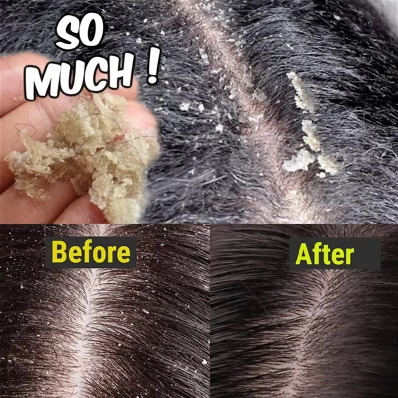 高速抗フケヘアトリートメント石鹸かゆみ修復頭皮クリーニング角 - Castor Oil Soap のレビューと価格